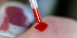 Anul trecut, cancerul de col uterin a ucis 22 de vasluience!