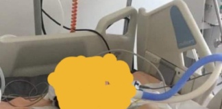 Primarul din Băcani, apel către locuitori să ajute un băiat care a suferit un accident de circulație