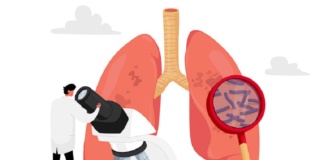 Testare gratuită pentru depistarea tuberculozei în 14 localități din județ