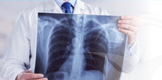 Cazurile de tuberculoză, în creștere